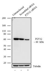 P2Y12 Antibody in Western Blot (WB)