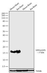 ANP Antibody in Western Blot (WB)