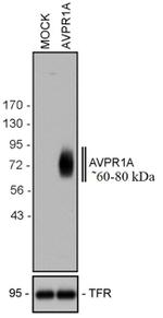 AVPR1A Antibody in Western Blot (WB)