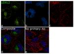 LOXL2 Antibody in Immunocytochemistry (ICC/IF)