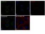 ALDH1A1 Antibody in Immunocytochemistry (ICC/IF)