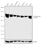 ATP Citrate Lyase Antibody in Western Blot (WB)