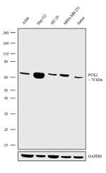 PCK2 Antibody in Western Blot (WB)