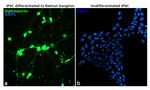 Optineurin Antibody in Immunocytochemistry (ICC/IF)