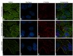 SOD1 Antibody in Immunocytochemistry (ICC/IF)