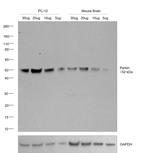 Parkin Antibody in Western Blot (WB)