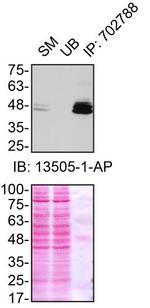 Ataxin 3 Antibody in Immunoprecipitation (IP)