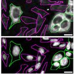 CK2 alpha-1 Antibody in Immunocytochemistry (ICC/IF)