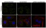 Catalase Antibody