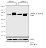 Phospho-beta Catenin (Thr41, Ser45) Antibody in Western Blot (WB)