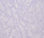 Transcription factor E3/TFE3 (Transcription Factor) Antibody in Immunohistochemistry (Paraffin) (IHC (P))