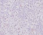 Transcription factor E3/TFE3 (Transcription Factor) Antibody in Immunohistochemistry (Paraffin) (IHC (P))