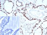 Transcription factor E3/TFE3 (Transcription Factor) Antibody in Immunohistochemistry (Paraffin) (IHC (P))