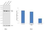 IGF2BP1 Antibody