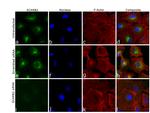 LIMP2 Antibody in Immunocytochemistry (ICC/IF)