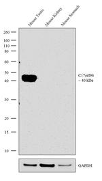 C17orf96 Antibody in Western Blot (WB)