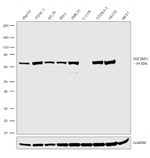 IGF2BP3 Antibody