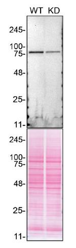 DDX1 Antibody in Western Blot (WB)