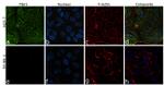 TBK1 Antibody in Immunocytochemistry (ICC/IF)