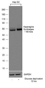 Asparagine Synthetase Antibody