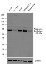 Asparagine Synthetase Antibody in Western Blot (WB)