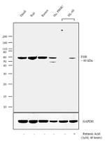 FGR Antibody in Western Blot (WB)