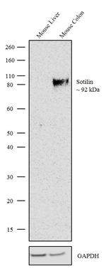 Sortilin Antibody in Western Blot (WB)