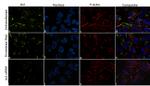 Axl Antibody in Immunocytochemistry (ICC/IF)