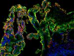 Transthyretin Antibody in Immunocytochemistry (ICC/IF)