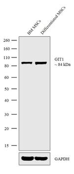 GIT1 Antibody in Western Blot (WB)