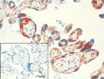 SSTR4 Antibody in Immunohistochemistry (IHC)