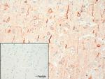 SSTR4 Antibody in Immunohistochemistry (IHC)