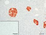 GPR30 Antibody in Immunohistochemistry (IHC)