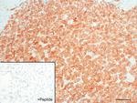 GPR30 Antibody in Immunohistochemistry (IHC)