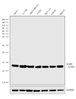 SLIRP Antibody in Western Blot (WB)