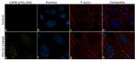 Phospho-beta Catenin (Thr41, Ser45) Antibody in Immunocytochemistry (ICC/IF)