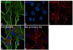 IL13RA2 Antibody in Immunocytochemistry (ICC/IF)