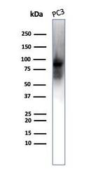 CD71/Transferrin Receptor (TFRC) Antibody in Western Blot (WB)