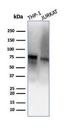 CD71/Transferrin Receptor (TFRC) Antibody in Western Blot (WB)