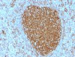 CD71/Transferrin Receptor (TFRC) Antibody in Immunohistochemistry (Paraffin) (IHC (P))