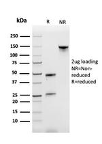 CD71/Transferrin Receptor (TFRC) Antibody in SDS-PAGE (SDS-PAGE)