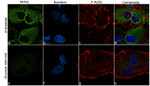 PKM2 Antibody in Immunocytochemistry (ICC/IF)