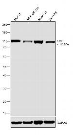 LSD1 Antibody in Western Blot (WB)