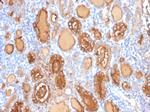 Thyroglobulin (Thyroidal Cell Marker) Antibody in Immunohistochemistry (Paraffin) (IHC (P))