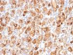 Thyroglobulin (Thyroidal Cell Marker) Antibody in Immunohistochemistry (Paraffin) (IHC (P))