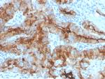 Thyroglobulin (Thyroidal Cell Marker) Antibody in Immunohistochemistry (Paraffin) (IHC (P))