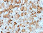 Thyroglobulin (Thyroidal Cell Marker) Antibody in Immunohistochemistry (Paraffin) (IHC (P))