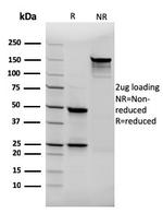 Thyroglobulin (Thyroidal Cell Marker) Antibody in SDS-PAGE (SDS-PAGE)