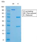 Thyroglobulin (Thyroidal Cell Marker) Antibody in SDS-PAGE (SDS-PAGE)