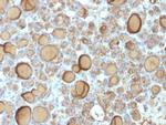 Thyroglobulin Antibody in Immunohistochemistry (Paraffin) (IHC (P))